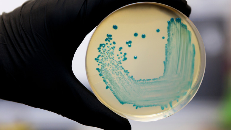 bacteria on ice cream lid 