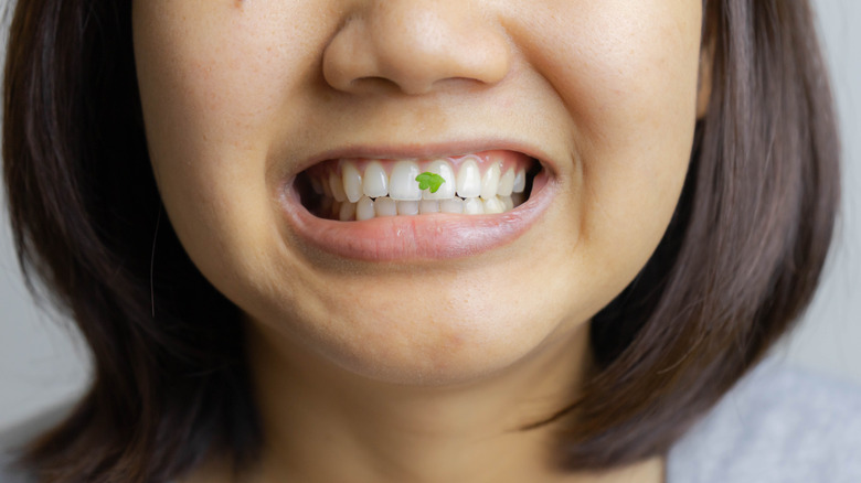 Woman with spinach stuck in her teeth
