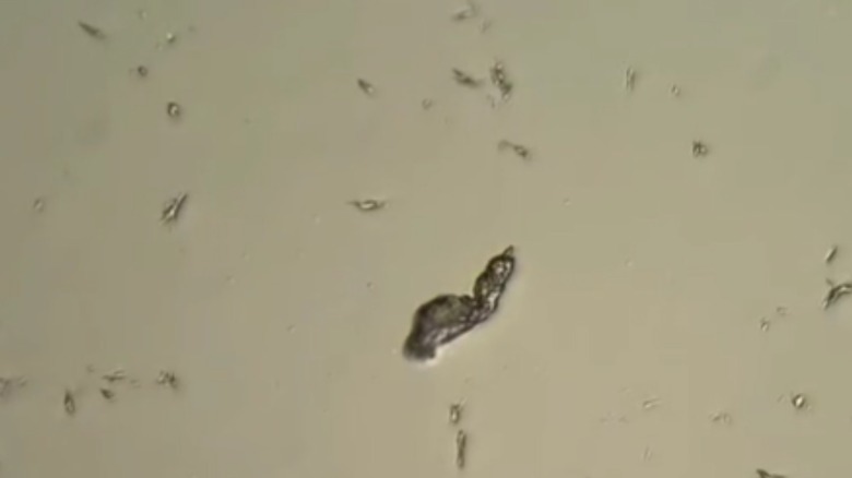 McDonald's water under microscope