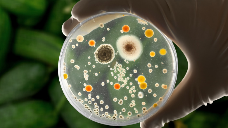 Petri dish with E. coli