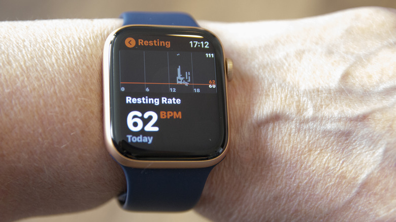 A person wearing an Apple Watch